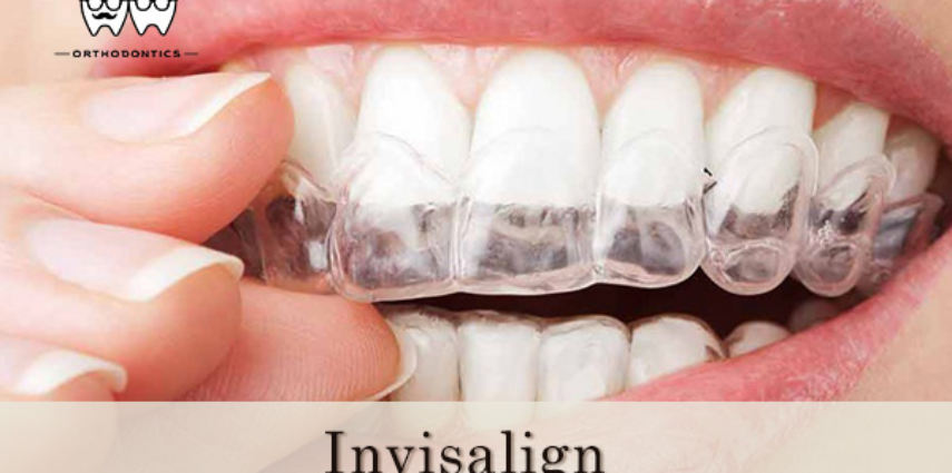 What are some good message boards about Invisalign?